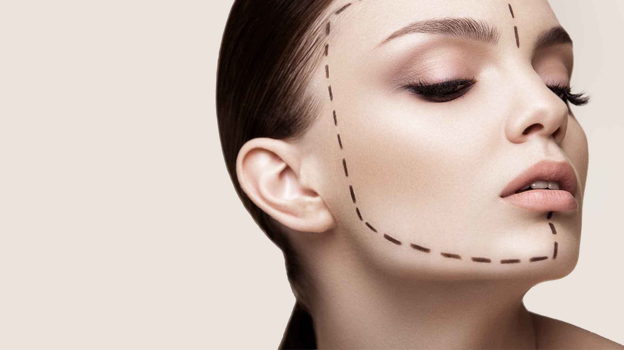 Facelift - Nach einem Facelift 10 Jahre jünger aussehen