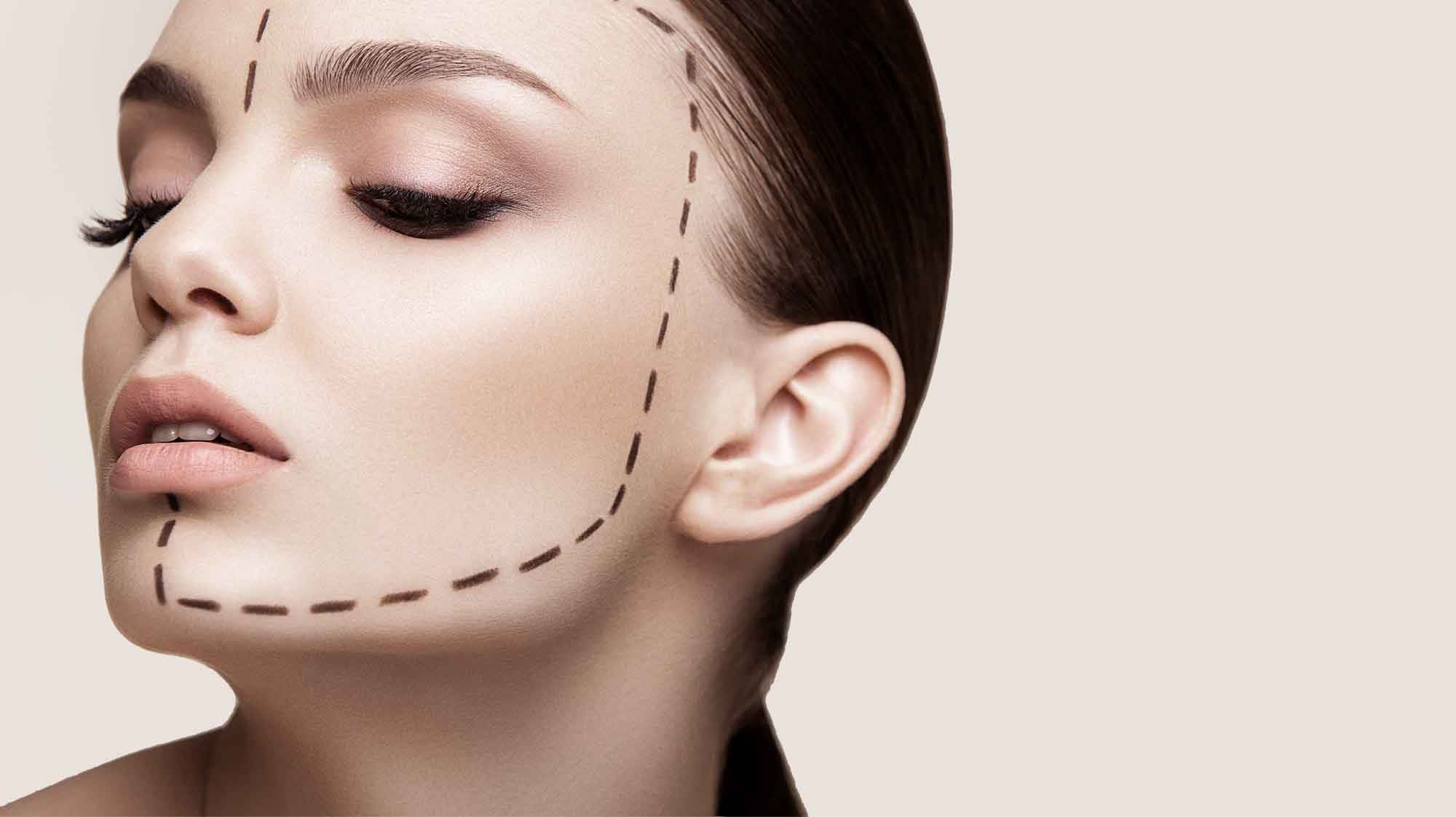 Faltenbehandlung - Botulinumtoxin & Hyaluronsäure